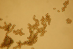 Pilzsporen von Cryptostoma